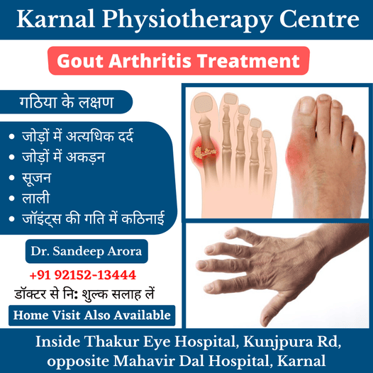 Gout Arthritis Treatment